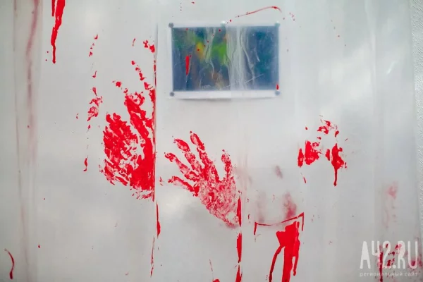 «Врачи пришли в ужас»: в Москве подросток выпил свою кровь и попал в реанимацию