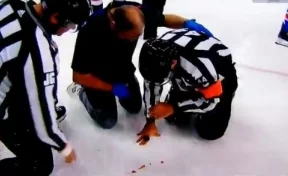 Во время матча хоккеист Овечкин разбил лицо арбитру