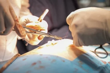 Фото: В Кемерове хирурги спасли пожилого пациента с редкой патологией 1
