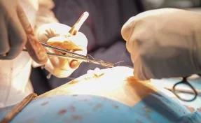В Кемерове хирурги спасли пожилого пациента с редкой патологией