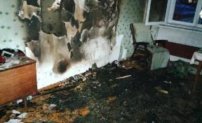 В Кузбассе при пожаре серьёзно пострадал двухлетний ребёнок