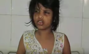 В Индии нашли «девочку-Маугли»