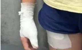 В Кузбассе за нападение собаки на ребёнка с её владельца взыскали 50 000 рублей