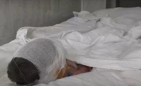 В Кемерове врачи спасли жизнь обгоревшему после игры со спичками ребёнку