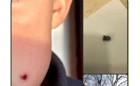 В Туапсе неизвестный выстрелил в 9-летнего мальчика из пневматического ружья