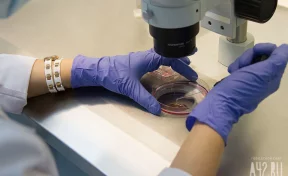 В Новой Москве семья нашла в малосольной рыбе шарики ртути